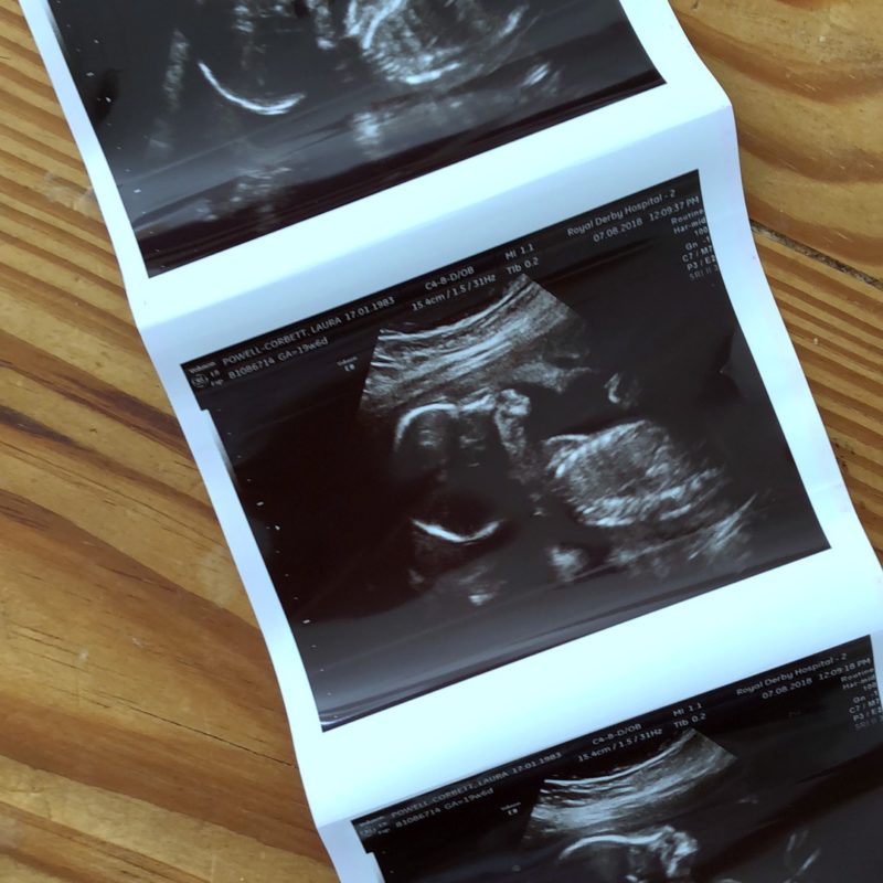 Perinatal Mental Health: My Journey with Antenatal Anxiety